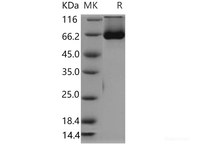 Recombinant Mouse SHP2 / PTPN11 Protein (His tag)-Elabscience