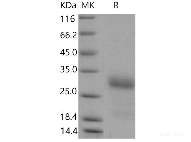 Recombinant Mouse IGFBP6 / IBP-6 Protein (His tag)-Elabscience