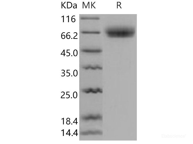 Recombinant Mouse Osteomodulin / OMD Protein (His tag)-Elabscience