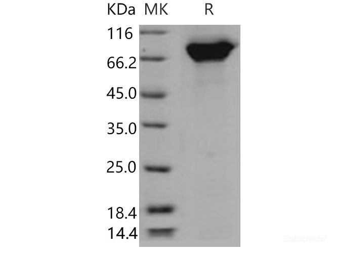 Recombinant Mouse Periostin / POSTN Protein (His tag)-Elabscience