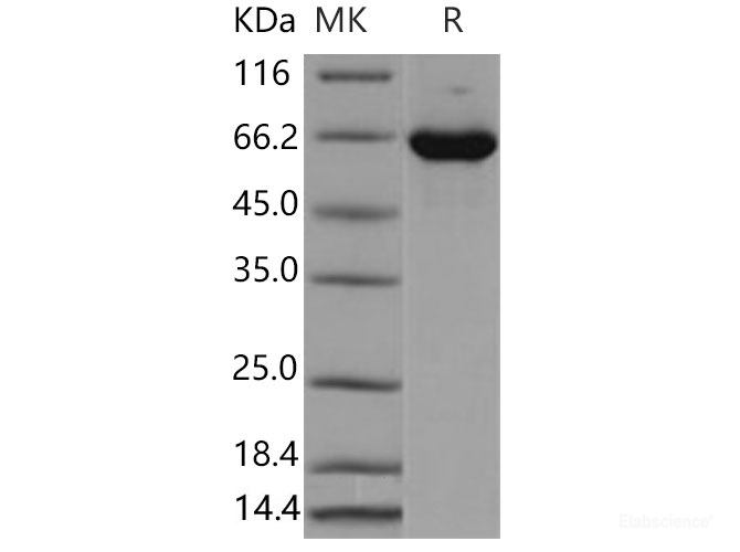 Recombinant Mouse ERK2 / MAPK1 / MAPK2 Protein (His & GST tag)-Elabscience