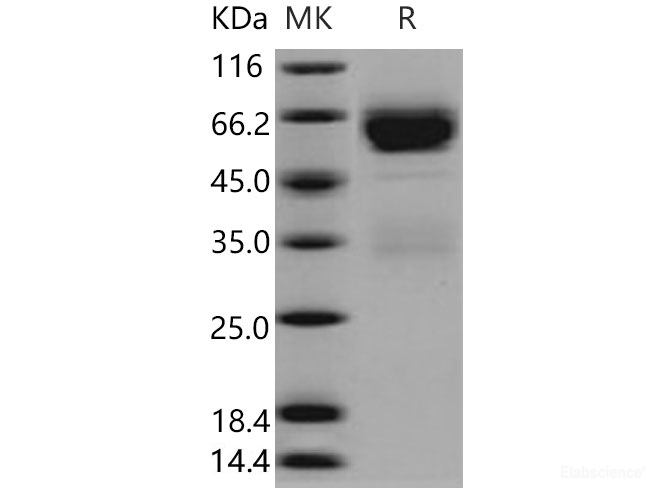Recombinant Mouse SerpinA11 Protein (His tag)-Elabscience