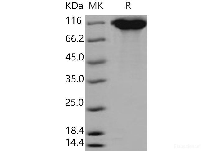 Recombinant Mouse LIFR / CD118 Protein (His tag)-Elabscience
