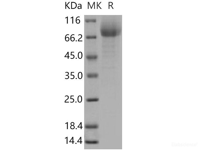 Recombinant Mouse CD36 / SCARB3 Protein (His tag)-Elabscience