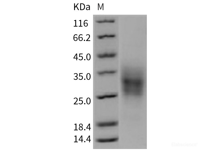 Recombinant Mouse TRAIL R2 / CD262 / TNFRSF10B Protein (His tag)-Elabscience