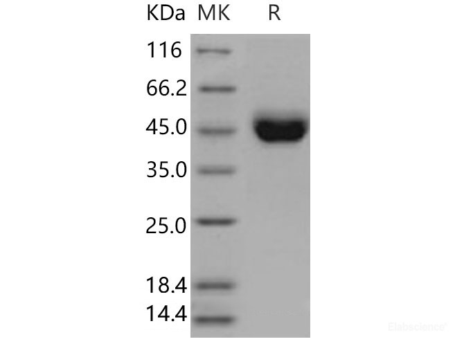 Recombinant Mouse  CD5 Protein (His Tag)-Elabscience