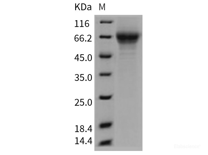 Recombinant Mouse THSD1 / TMTSP Protein (His tag)-Elabscience