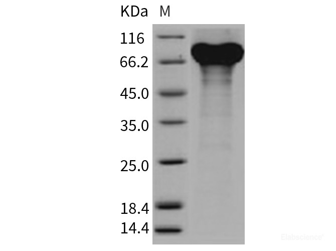 Recombinant Mouse Granulin / GRN / Progranulin Protein (His tag)-Elabscience