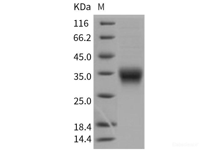 Recombinant Mouse CD8a / Lyt2 Protein (His tag)-Elabscience