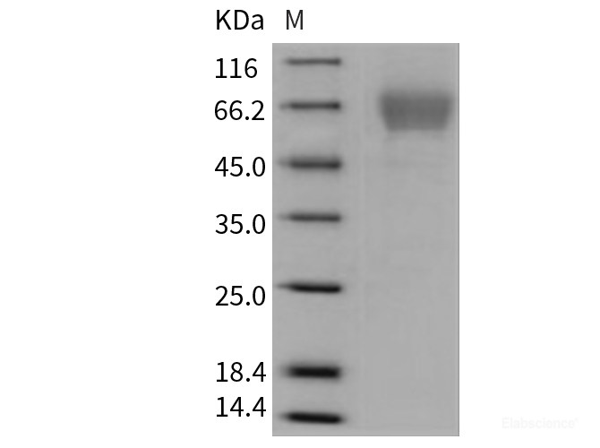 Recombinant Mouse TIM4 / TIMD4 Protein (His tag)-Elabscience