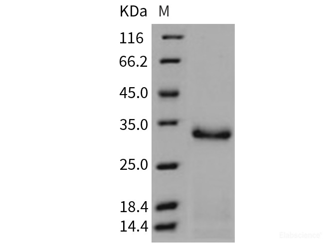 Recombinant Mouse Trypsin 2 / PRSS2 Protein (His tag)-Elabscience