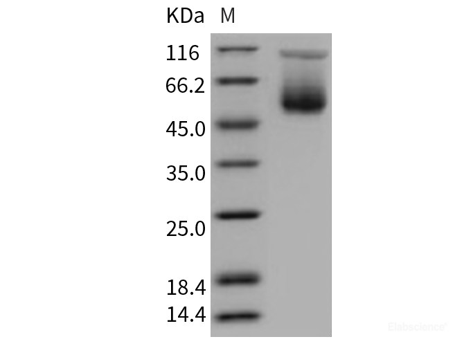 Recombinant Mouse SerpinA3c Protein (His tag)-Elabscience