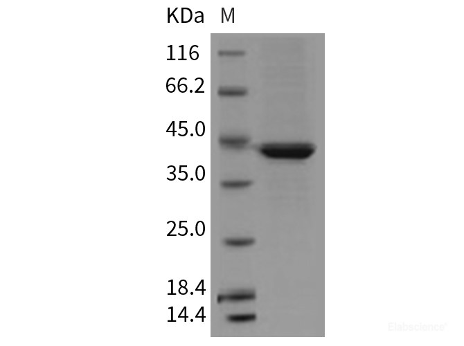 Recombinant Mouse Serpinb6b Protein (His tag)-Elabscience