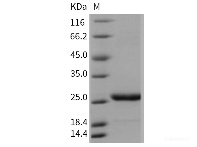 Recombinant Mouse PRL / Prolactin Protein (His tag)-Elabscience