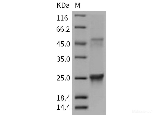 Recombinant Mouse GLO1 / Glyoxalase 1 Protein (His tag)-Elabscience