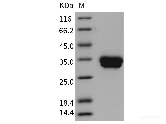 Recombinant Mouse Carbonic Anhydrase IV / Car4 Protein (His tag)-Elabscience
