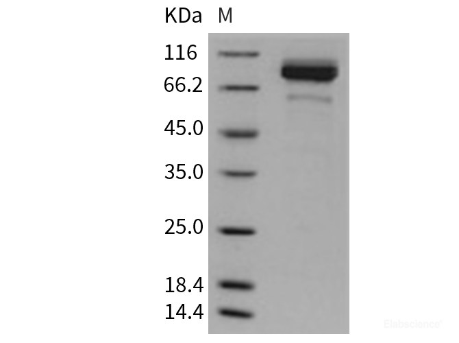 Recombinant Mouse Coagulation Factor II / FII / F2 Protein (His tag)-Elabscience