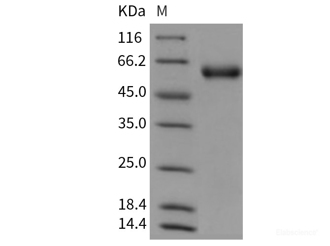 Recombinant Mouse Angiotensinogen / SerpinA8 / AGT Protein (His tag)-Elabscience