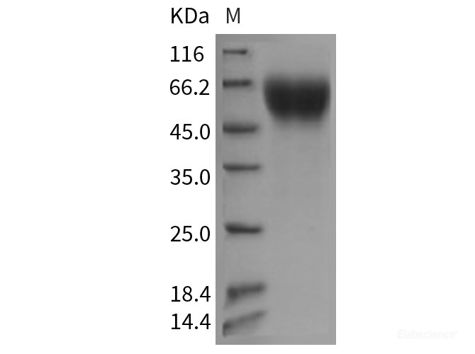 Recombinant Mouse IL17RA / IL17R / CD217 Protein (His tag)-Elabscience