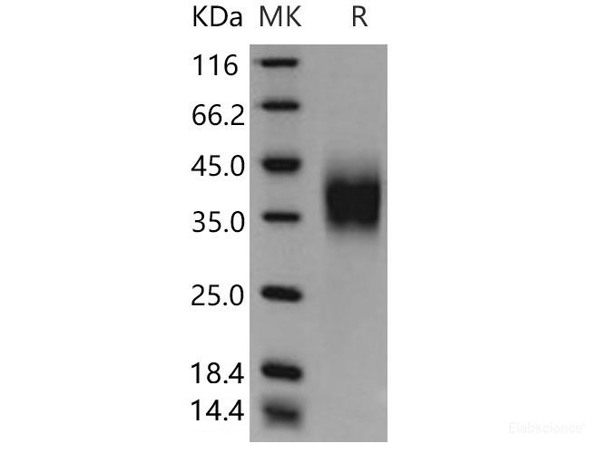Recombinant Mouse  CD16 Protein (His Tag)-Elabscience