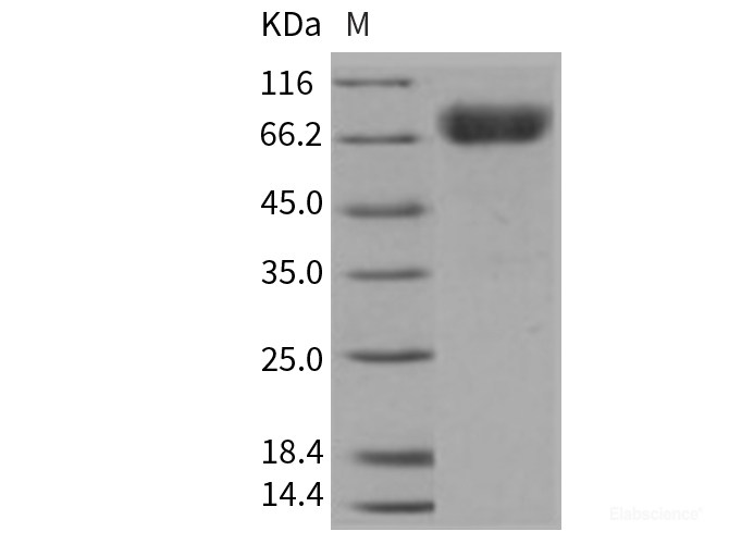 Recombinant Mouse KIM-1 / TIM1 / HAVCR1 Protein (His & Fc tag)-Elabscience