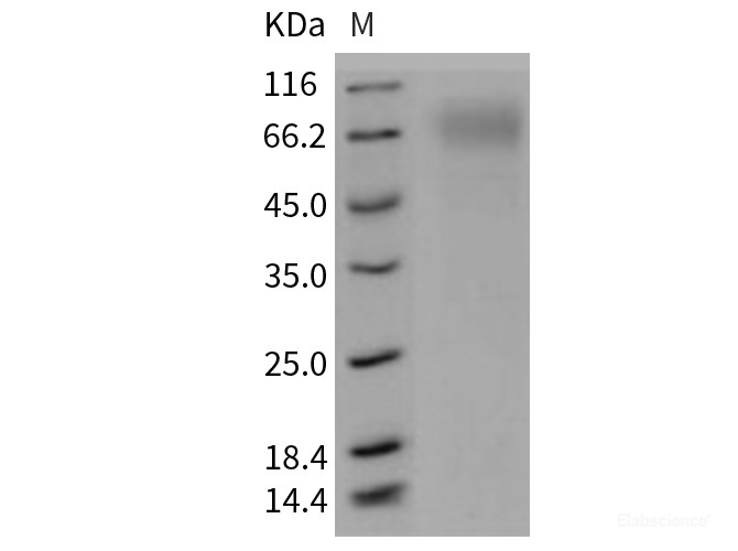 Recombinant Mouse SCARB1 / CD36L1 / CLA-1 Protein (His tag)-Elabscience