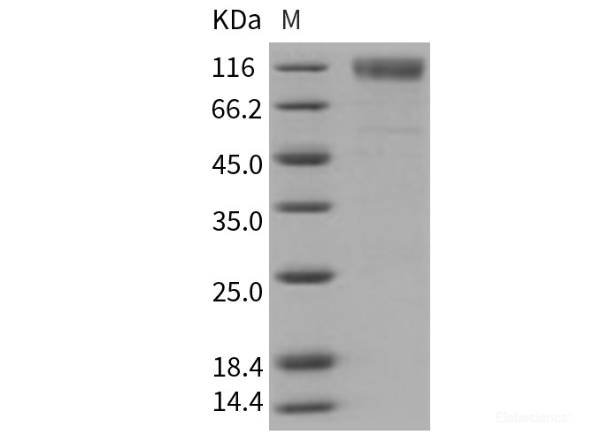 Recombinant Mouse SCARB1 / CD36L1 / CLA-1 Protein (His & Fc tag)-Elabscience