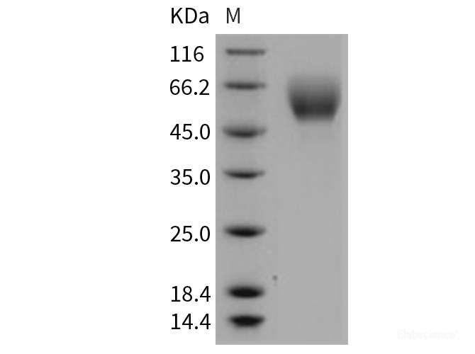 Recombinant Mouse SerpinA6 / CBG Protein (His tag)-Elabscience