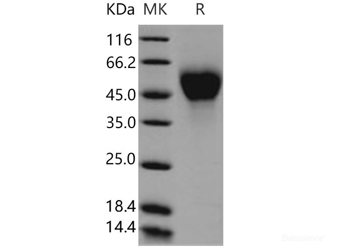 Recombinant Mouse  CD25 Protein (His Tag)-Elabscience