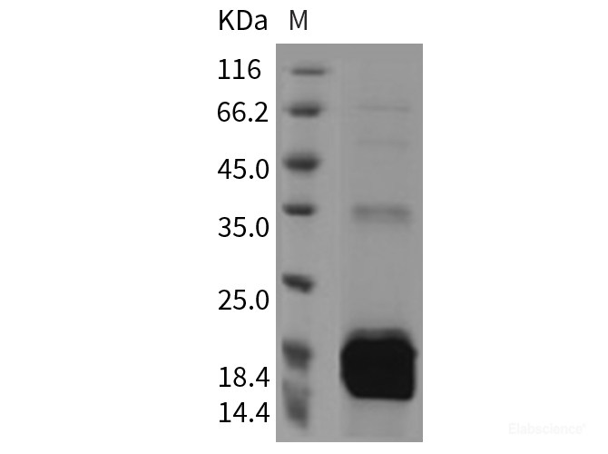 Recombinant Mouse S100A9 / CAGB / p14 Protein (His tag)-Elabscience
