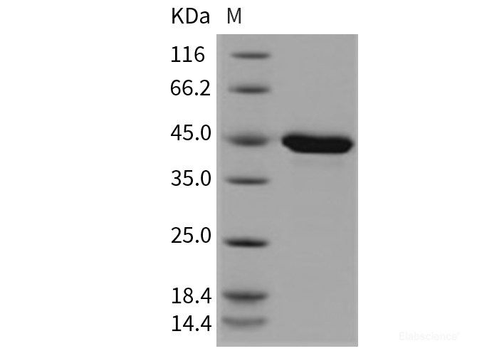 Recombinant Mouse PPM1A / PP2CA / PP2C-alpha Protein (His tag)-Elabscience