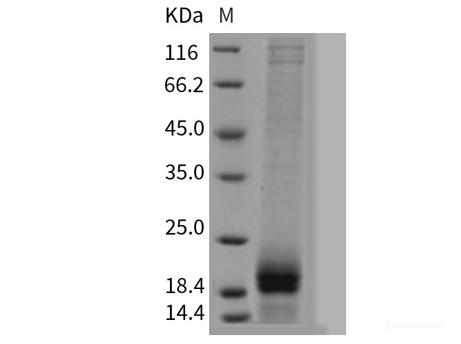 Recombinant Mouse AGRP / AgRP Protein (His tag)-Elabscience