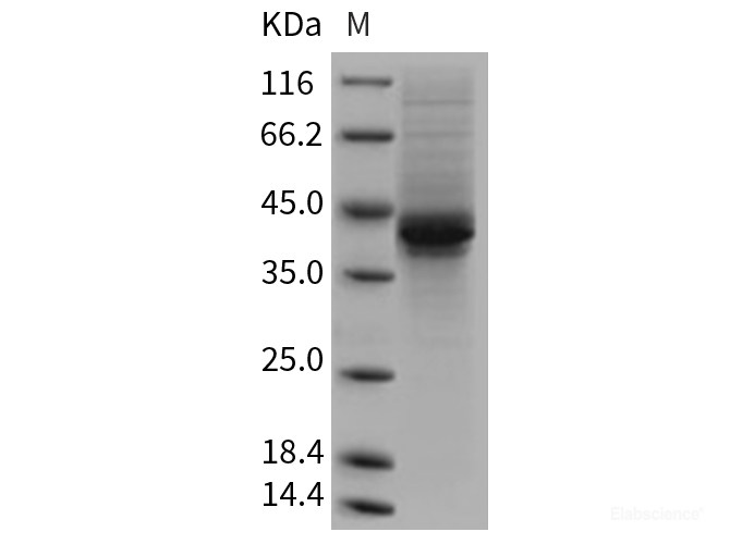Recombinant Mouse AGRP Protein (Fc tag)-Elabscience