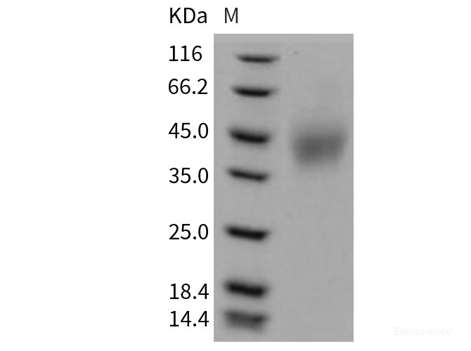 Recombinant Mouse SLAMF6 Protein (His Tag)-Elabscience