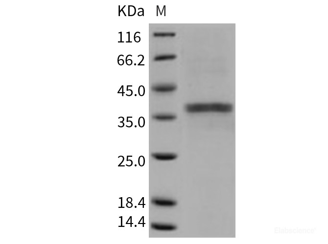 Recombinant Mouse ACP5 / TRAP Protein (His tag)-Elabscience