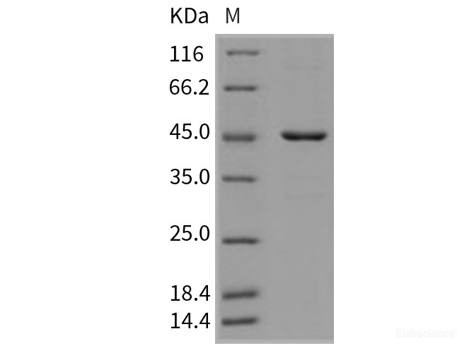 Recombinant Mouse HDAC8 / HDACL1 Protein (His tag)-Elabscience