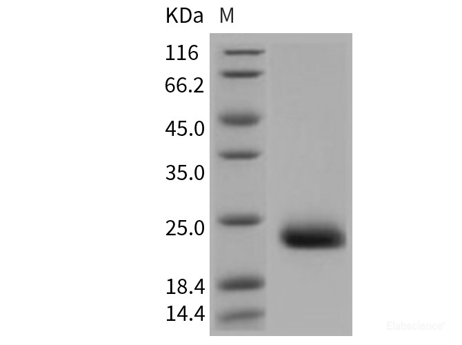 Recombinant Mouse CLEC4N / CLEC6A / Dectin-2 Protein (His tag)-Elabscience