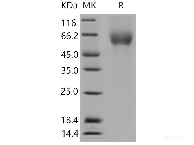 Recombinant Mouse  CD155 / PVR Protein (His Tag)-Elabscience