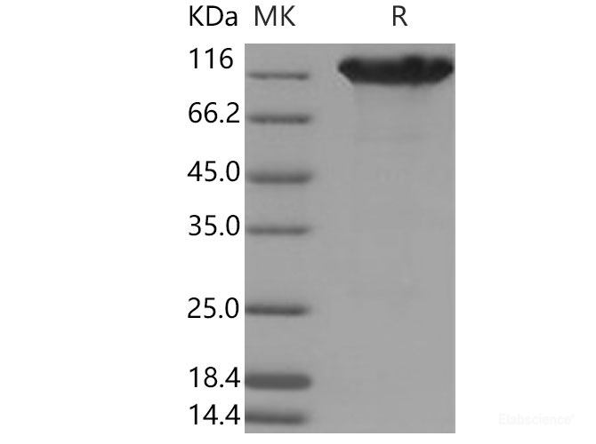 Recombinant Mouse ACE2 / Angiotensin-Converting Enzyme 2 Protein (His & Fc tag)-Elabscience
