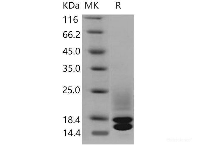 Recombinant Mouse Cystatin C / CST3 Protein (His tag)-Elabscience