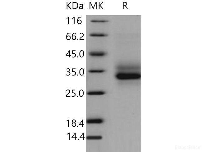 Recombinant Mouse CLEC7A / Dectin-1 / CLECSF12 Protein (His tag)-Elabscience