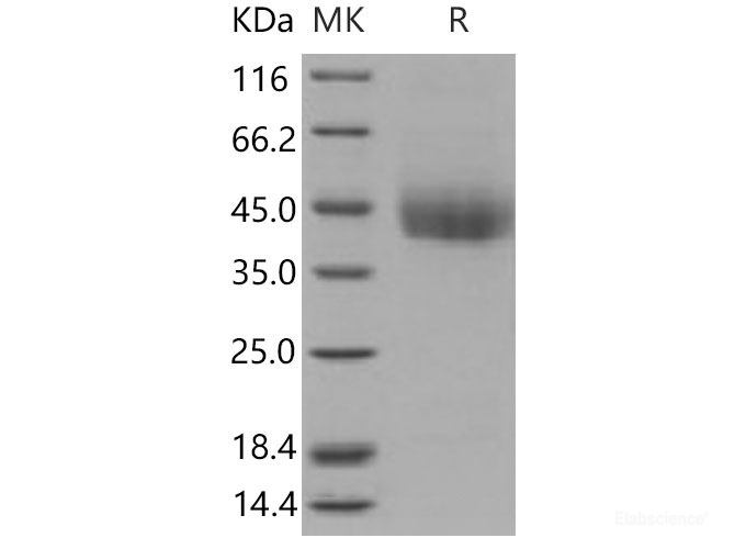 Recombinant Mouse  CD226 Protein (His Tag)-Elabscience