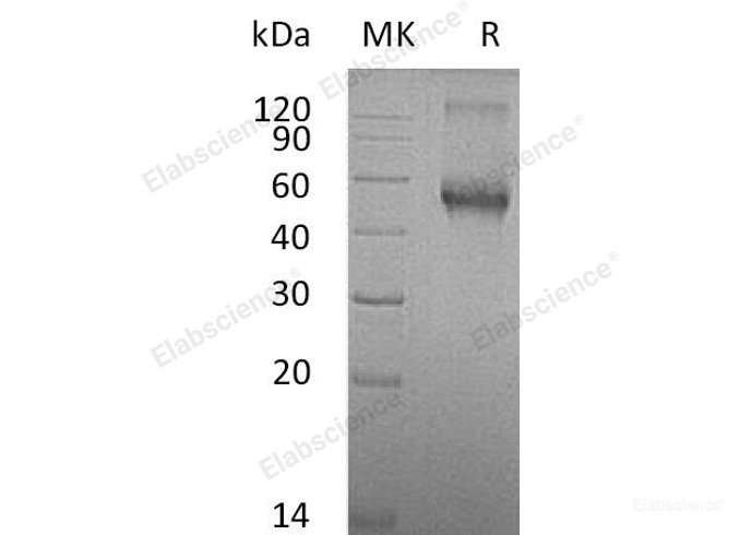 Recombinant Mouse  ALK-1 Protein (His &Fc Tag)-Elabscience