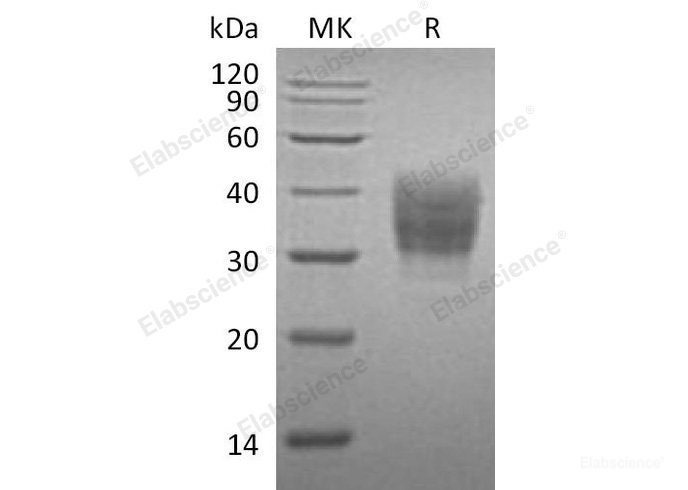 Recombinant Mouse  SLAMF7/CD319 Protein (His Tag)-Elabscience