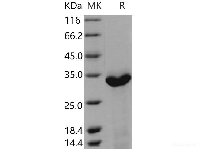 Recombinant Mouse HABP1 / C1QBP Protein (His tag)-Elabscience