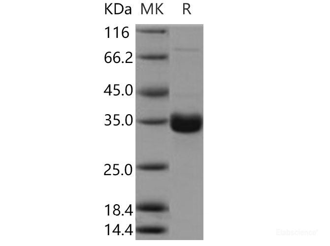 Recombinant Mouse CL-K1 / COLEC11 Protein (His tag)-Elabscience