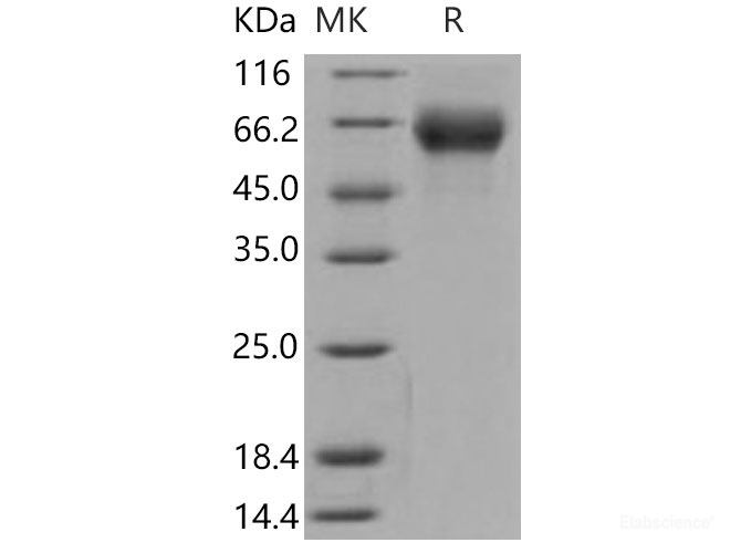 Recombinant Mouse FGFR4 / CD334 Protein (His tag)-Elabscience