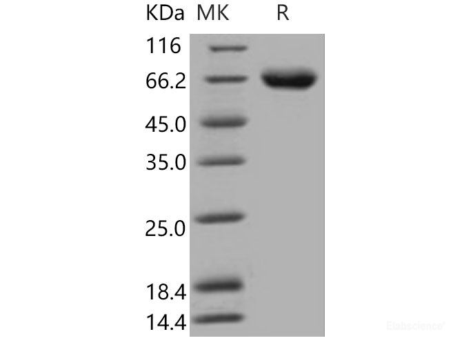 Recombinant Mouse KIRREL1 / NEPH1 Protein (His tag)-Elabscience