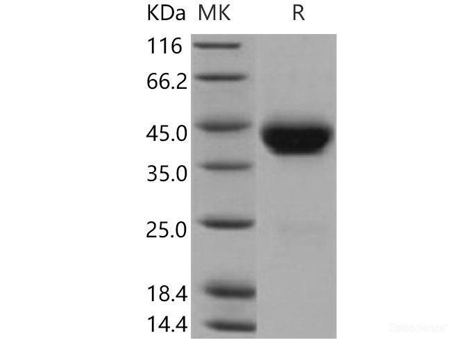 Recombinant Mouse SCARB3 Protein (His tag)-Elabscience