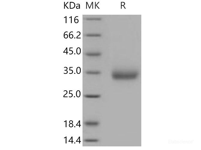 Recombinant Mouse VSIG4 Protein (His tag)-Elabscience